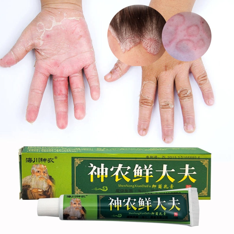 15g Natural Chinese Medicine Herbal Anti Bacteria Cream - Self-Improvement Lions Den